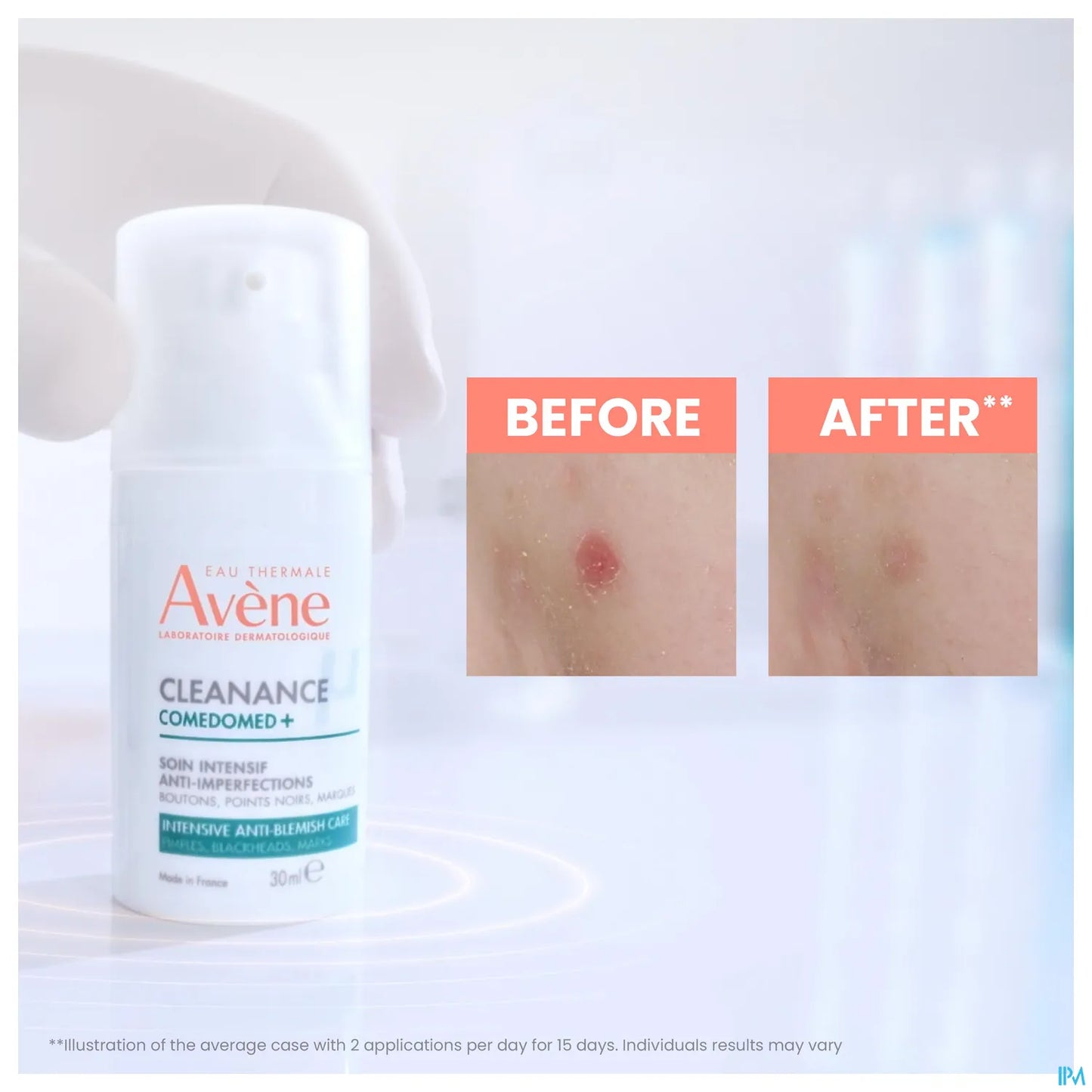 Cleanance Comedomed+ 30 ml