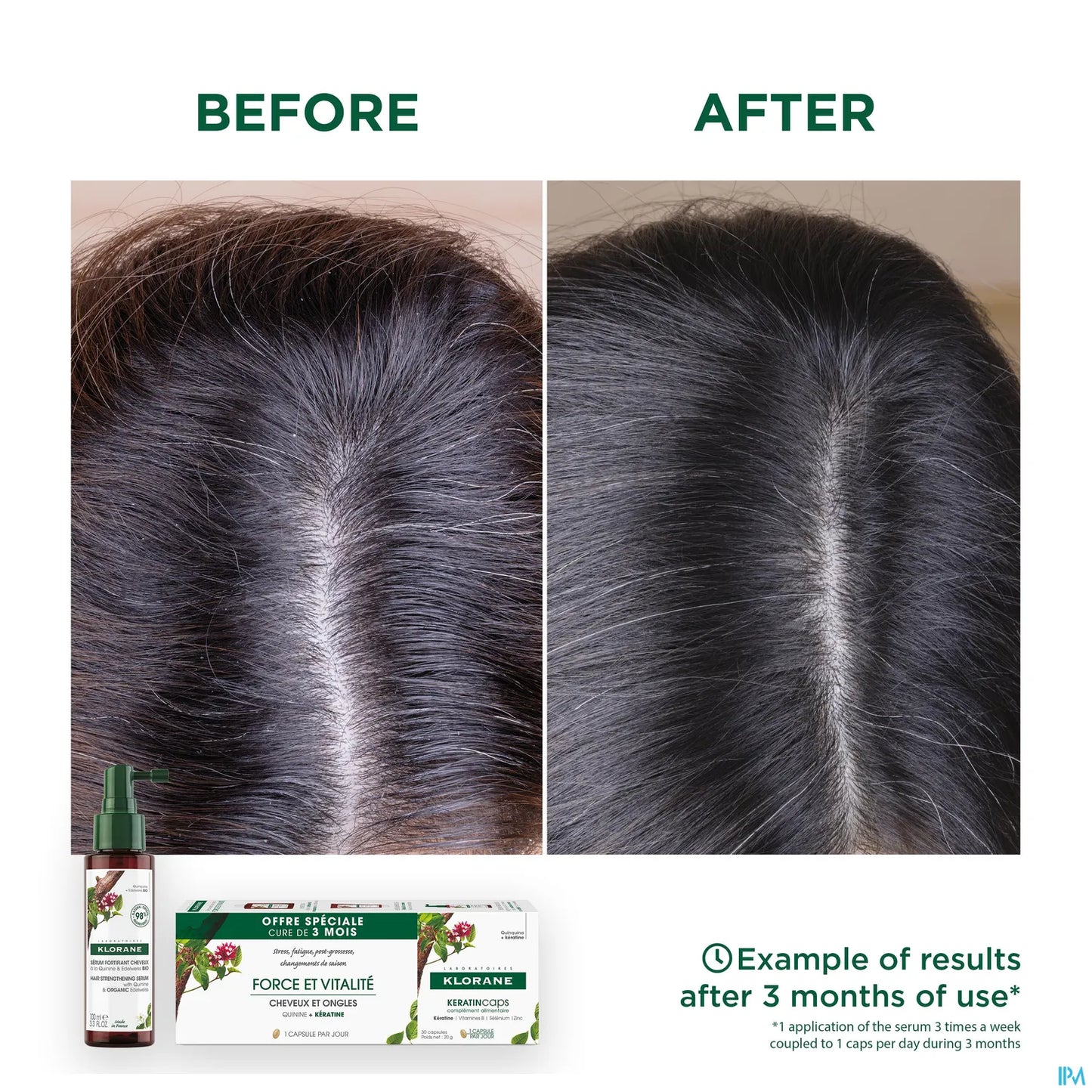 Keratincaps Complement Alimentaire Capsules Cheveux Ongles 90 Capsules