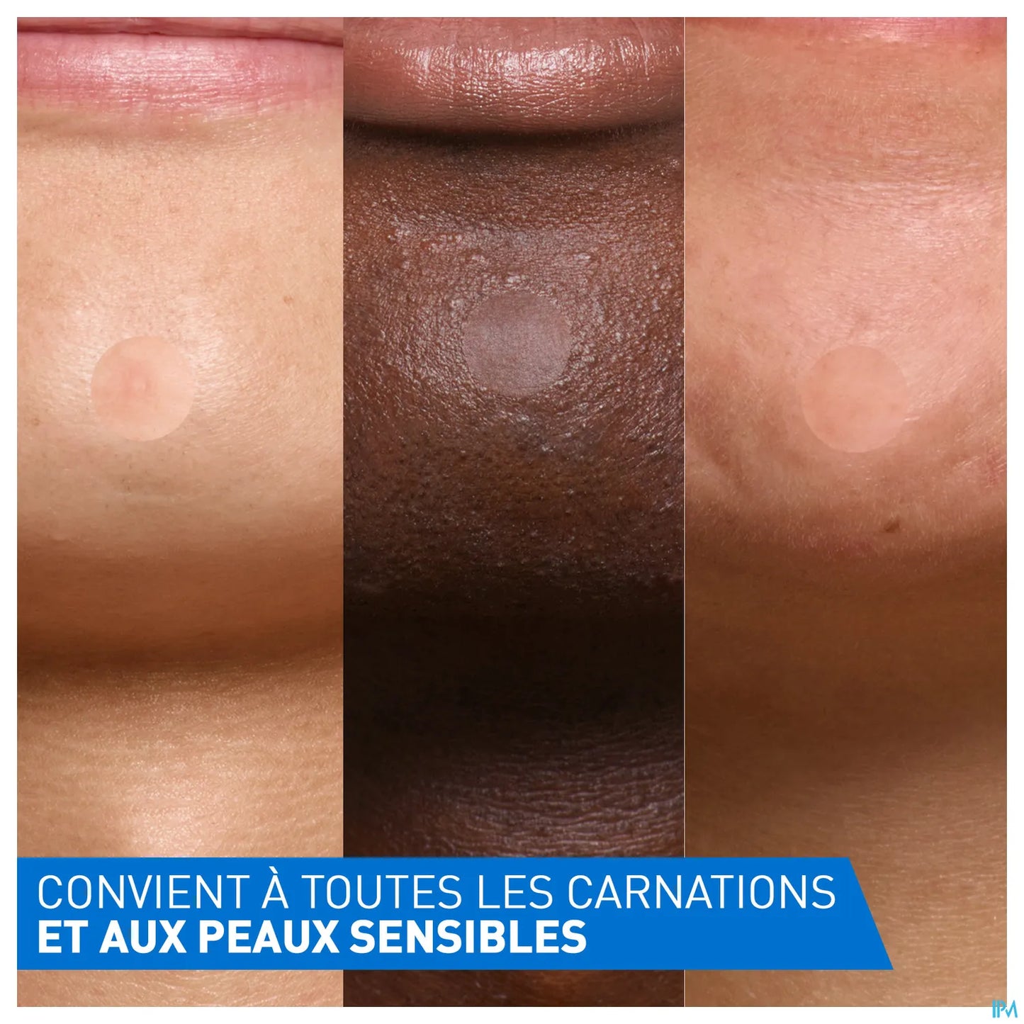 Patch Anti Imperfections 22 Unités