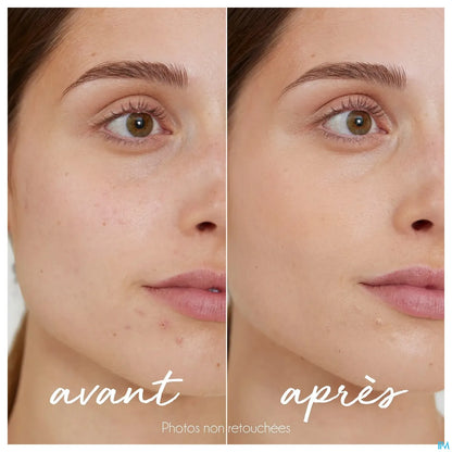 Stick Correcteur Teinté Anti-Imperfections 5.5g