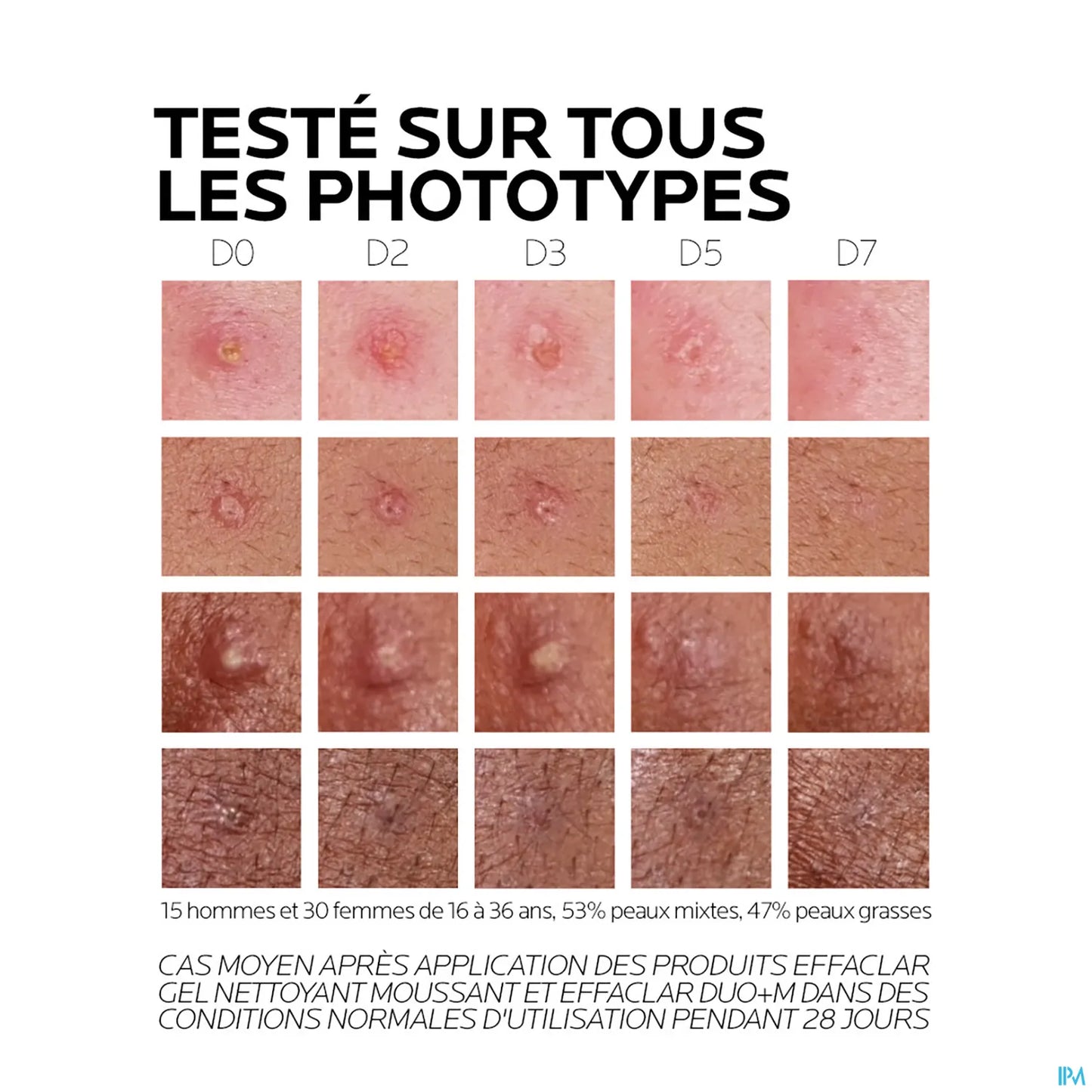 Effaclar Duo+M Crème Visage Anti-Imperfections 40ml