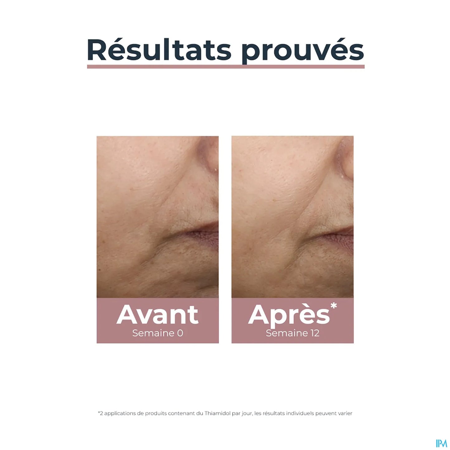 Anti-Pigment Day SPF 30 Tinted Light 50ml