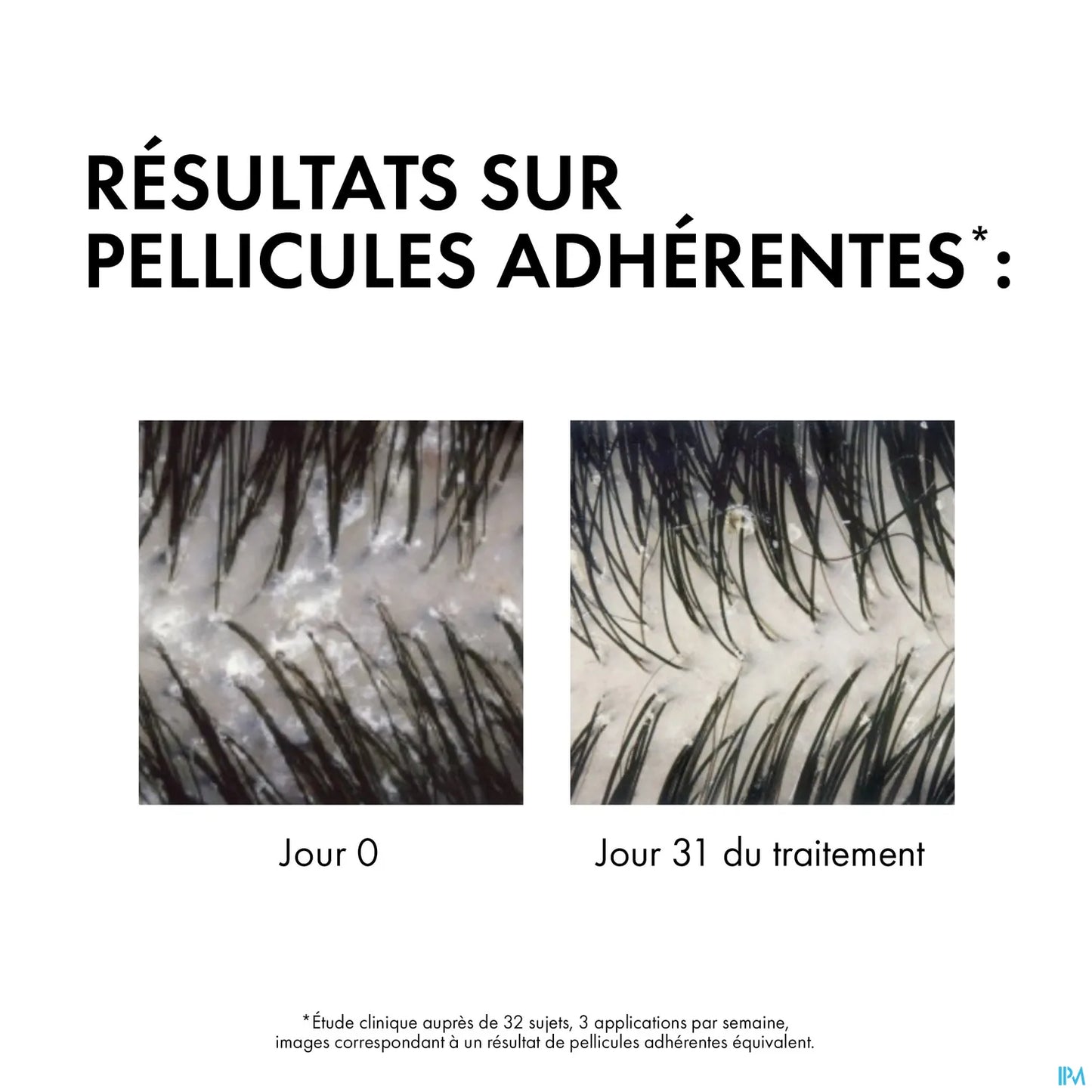 Dercos Anti-Dandruff Treatment Shampoo Eco-Refill Oily Hair 400ml