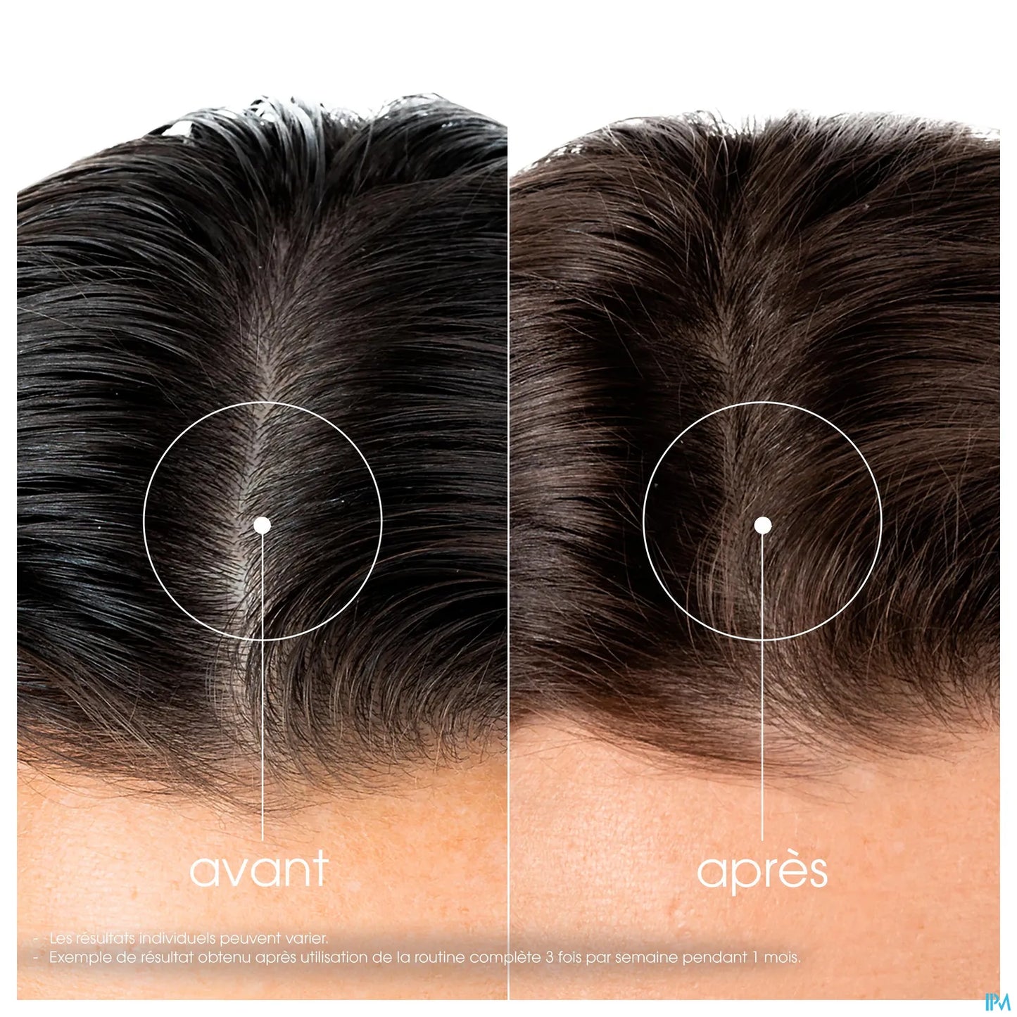 Shampooing à la Quinine et Edelweiss Bio 200ml