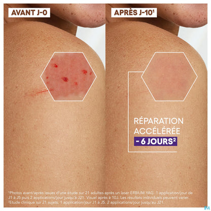 A Derma Epitheliale Ultra Repair Crème Réparatrice Anti Marques 100 mL
