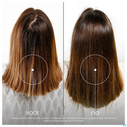 Shampooing à la Quinine et Edelweiss Bio 200ml