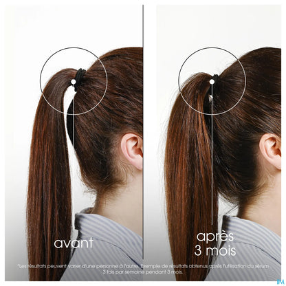 Intense Fortifying Treatment with Quinine 100 ML