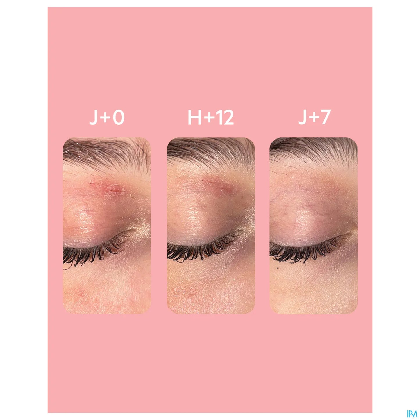 Palpebral Baume Apaisant Anti-Irritation Visage et Yeux 30ml