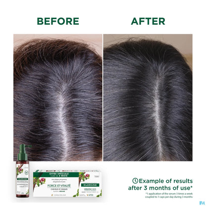 Keratincaps Complement Alimentaire Capsules Cheveux Ongles 90 Capsules