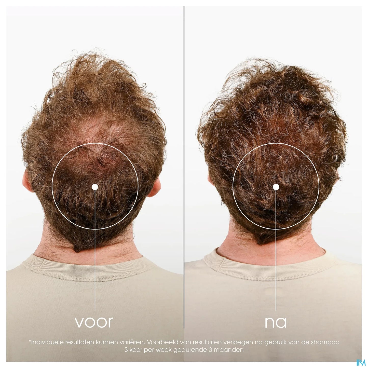 Shampooing à la Quinine et Edelweiss Bio 200ml