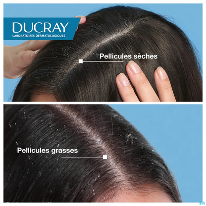 Squanorm Lotion Fresh Control 200 ml