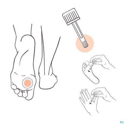 Aromaderm Verrucarom Solution Pieds et Mains 10 mL