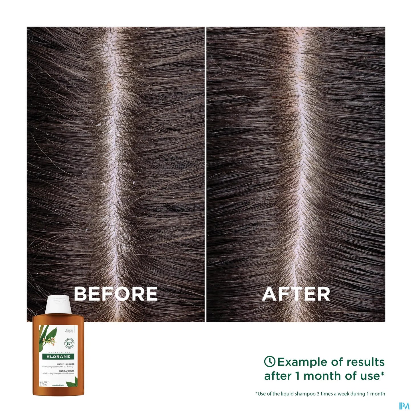 Shampooing Rééquilibrant Antipelliculaire Au Galanga 400ml