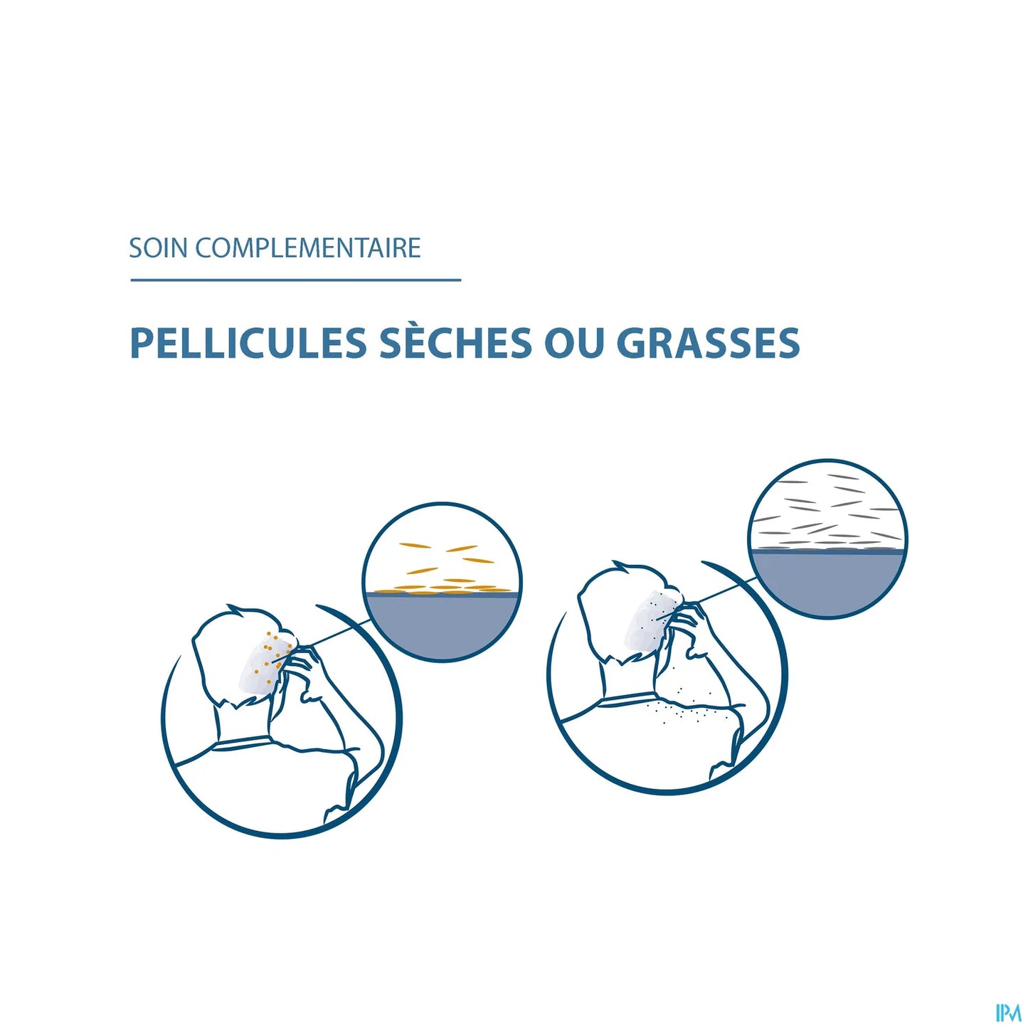 Squanorm Lotion Antipelliculaire Zinc 200 ml