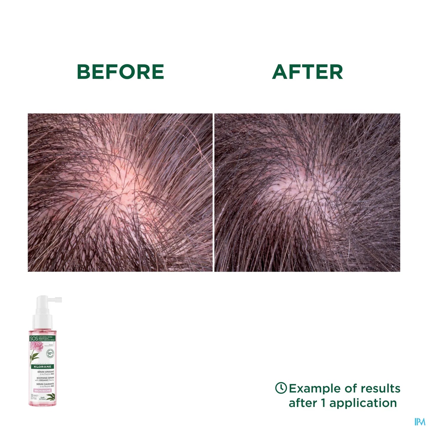 Sérum SOS Apaisant à la Pivoine Bio 100ml