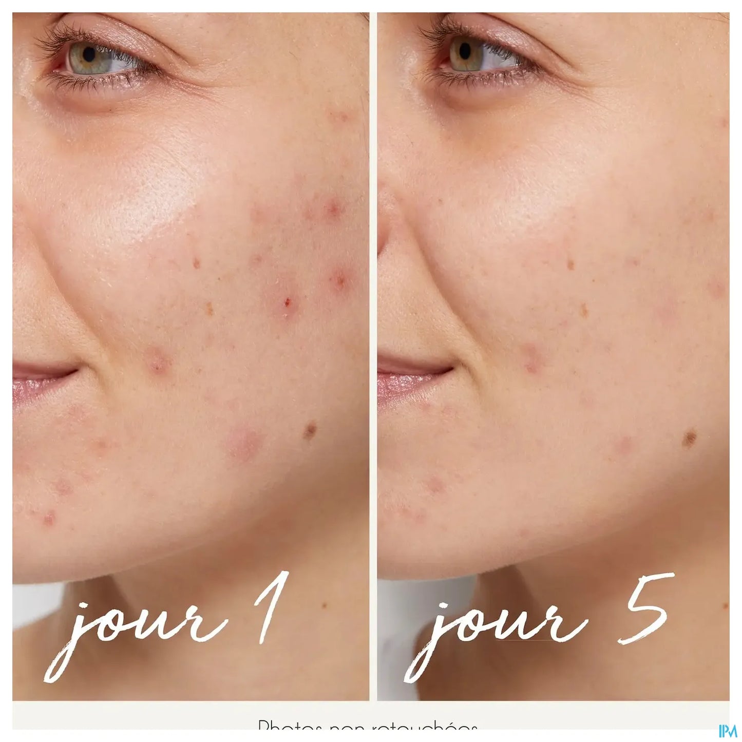 Sérum Purifiant Anti-Imperfections 30ml