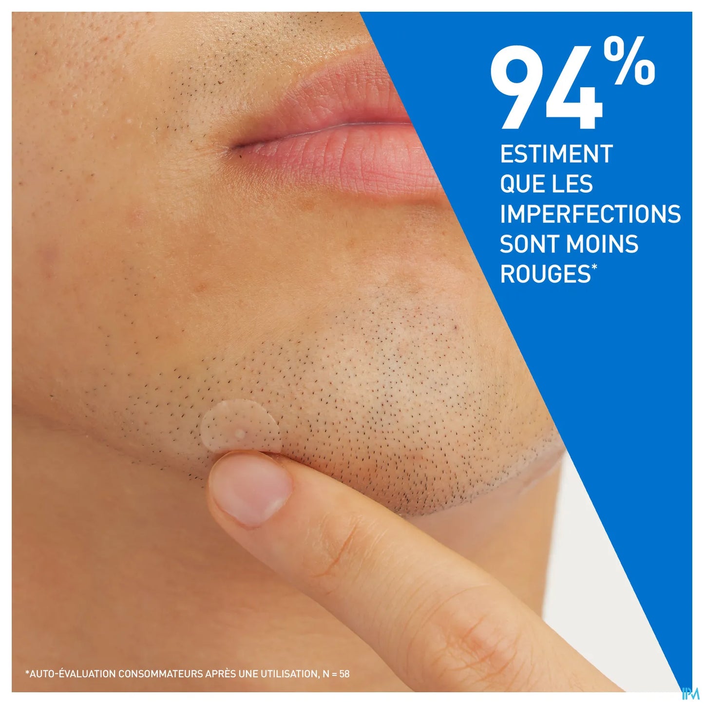 Patch Anti Imperfections 22 Unités
