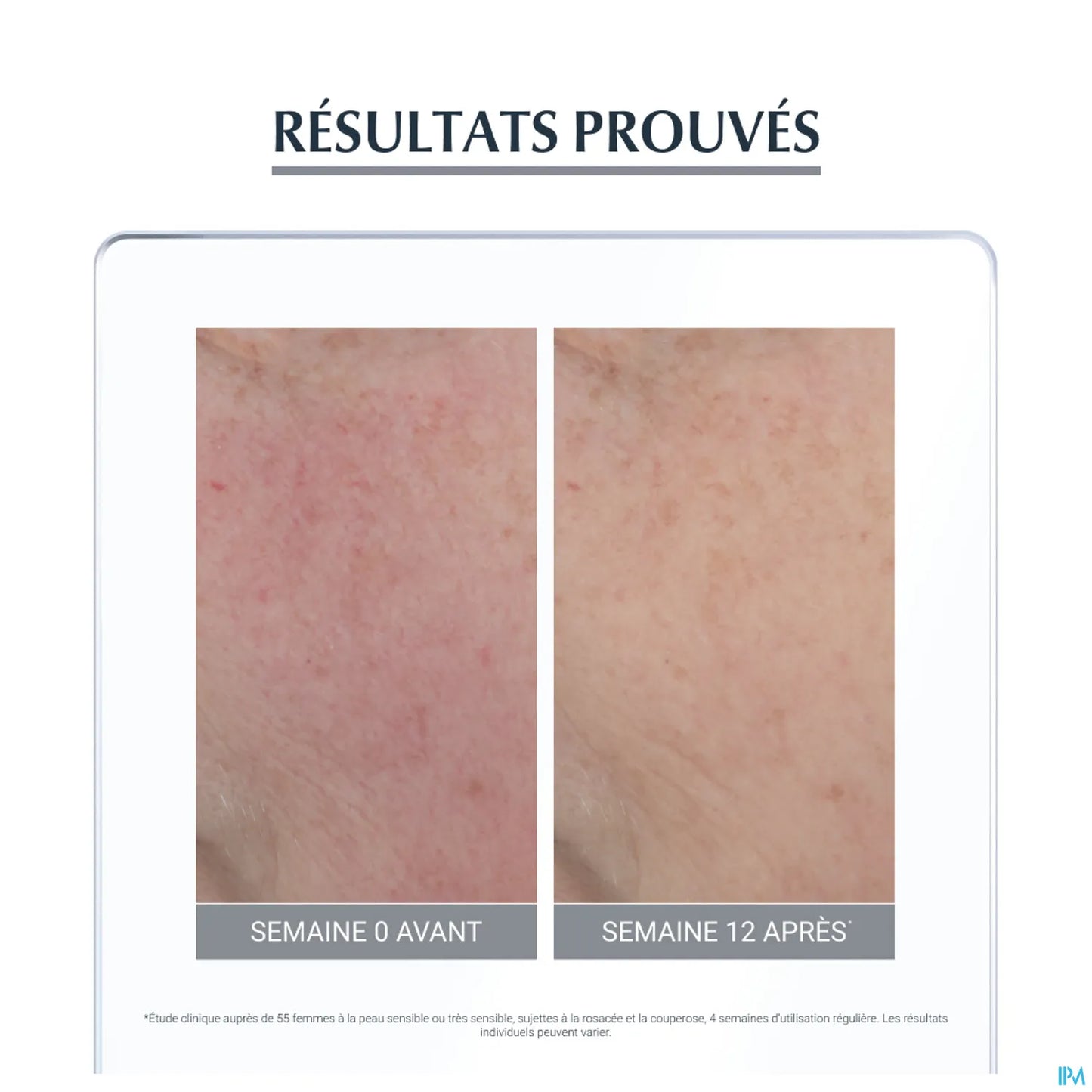 Anti Rougeurs Soin Apaisant 50ML