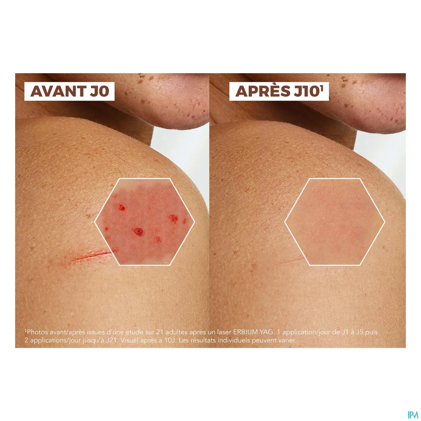 A Derma Epitheliale Ultra Repair Crème Réparatrice Anti Marques 40 mL